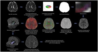 Cerebellar and basal ganglia structural connections in humans: Effect of aging and relation with memory and learning